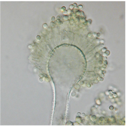 Aspergillus Flavus4e838840 Add3 4d75 91c9 31110b5f569b Microscopic image of Aspergillus flavus