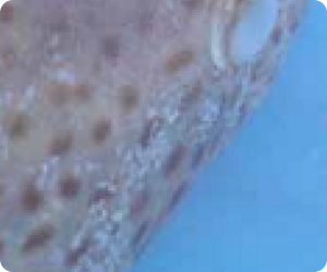 Prevention and Control of Monogenean Parasites in Fish Prevention and Control of Monogenean Parasites in Fish