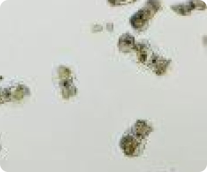 Rotifer Culture Technology for Hatchery Production7906197a Be8a 40d7 Ace1 Bc7790a692d4 Rotifer Culture Technology for Hatchery Production7906197a Be8a 40d7 Ace1 Bc7790a692d4